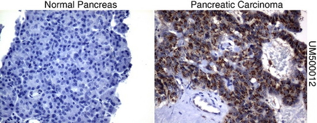 SQSTM1 Antibody in Immunohistochemistry (Paraffin) (IHC (P))