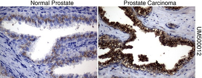 SQSTM1 Antibody in Immunohistochemistry (Paraffin) (IHC (P))