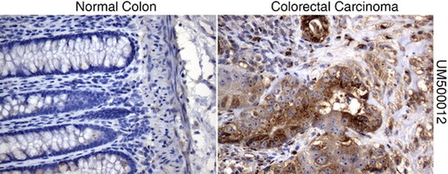 SQSTM1 Antibody in Immunohistochemistry (Paraffin) (IHC (P))