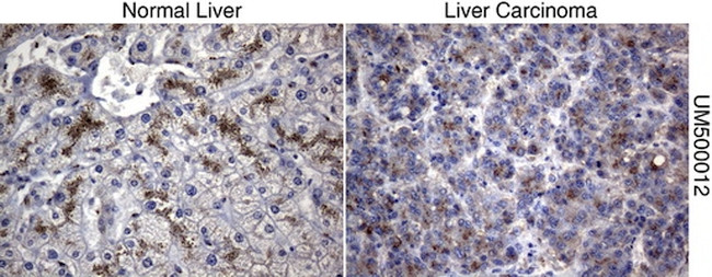 SQSTM1 Antibody in Immunohistochemistry (Paraffin) (IHC (P))