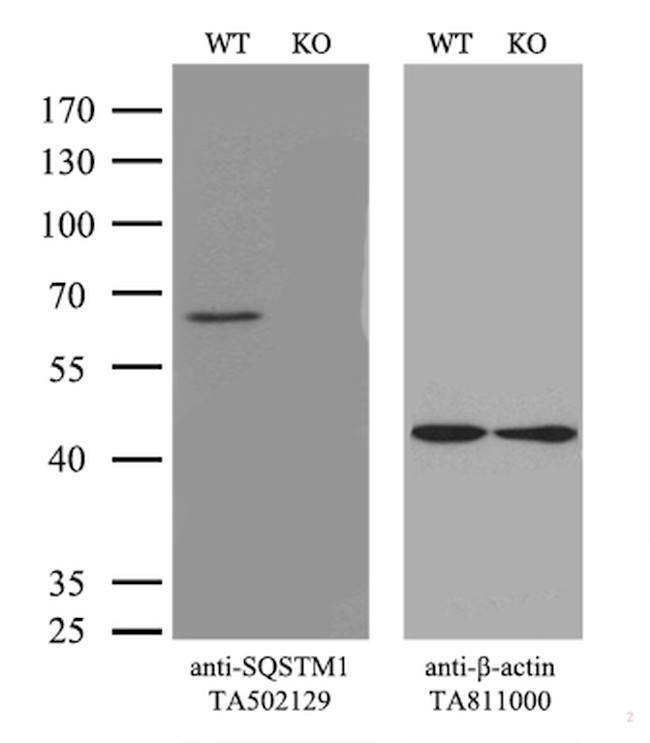 SQSTM1 Antibody