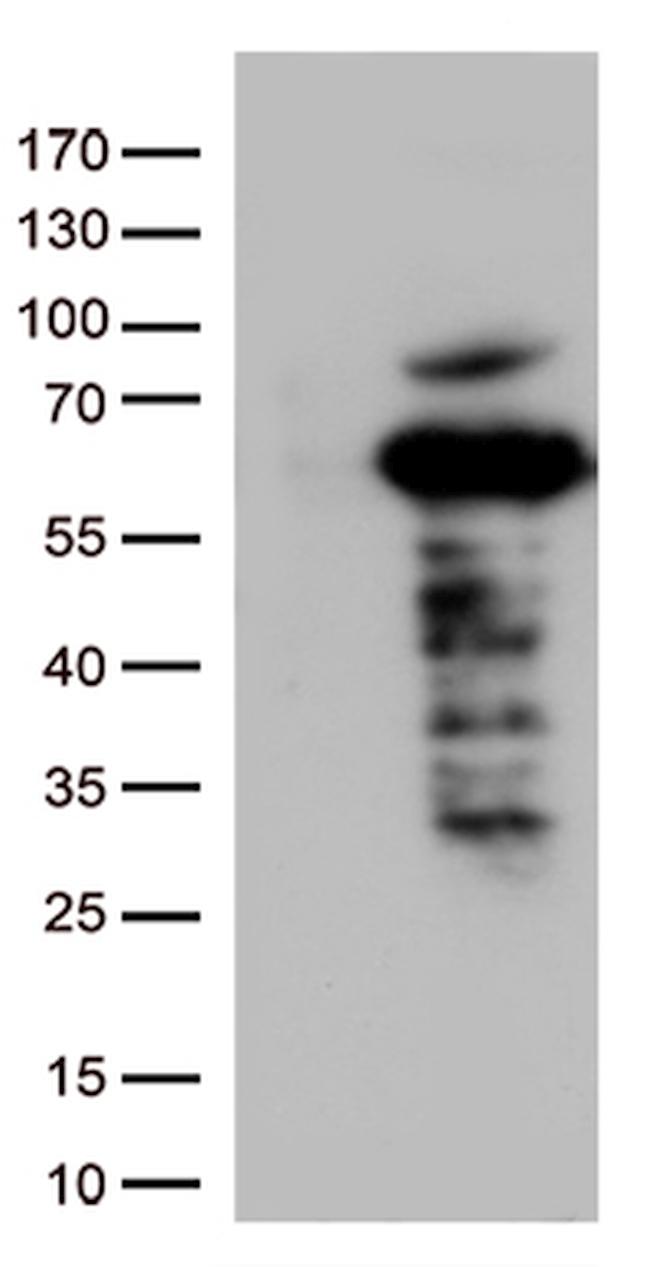 SQSTM1 Antibody in Western Blot (WB)