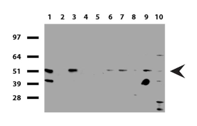 SQSTM1 Antibody in Western Blot (WB)