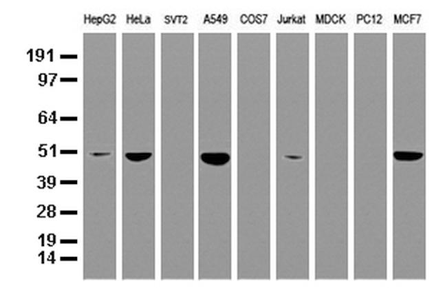 SQSTM1 Antibody in Western Blot (WB)