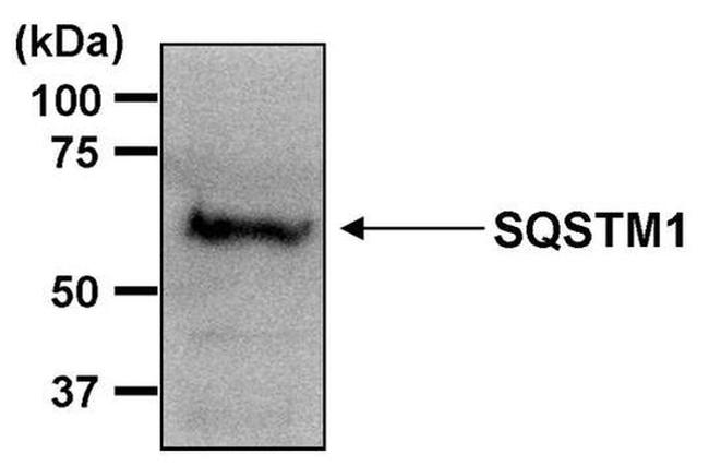 SQSTM1 Antibody in Western Blot (WB)