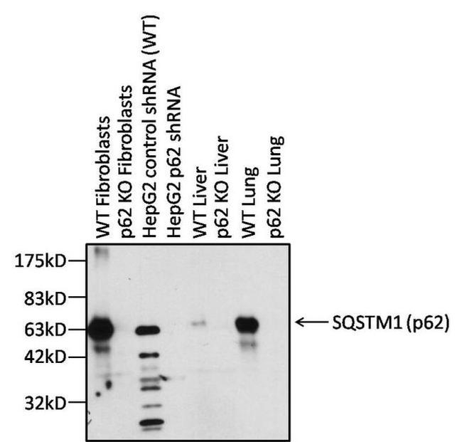 SQSTM1 Antibody in Western Blot (WB)