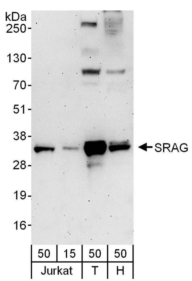 SRAG Antibody in Western Blot (WB)