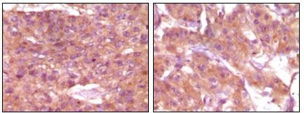 SRA1 Antibody in Immunohistochemistry (Paraffin) (IHC (P))