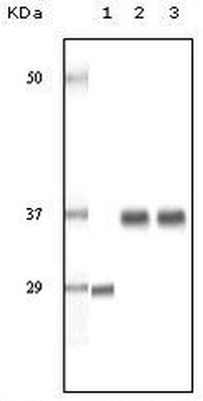 SRA1 Antibody in Western Blot (WB)