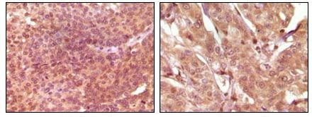 SRA1 Antibody in Immunohistochemistry (Paraffin) (IHC (P))