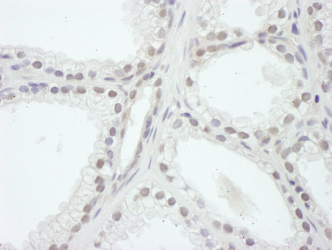 SRC1 Antibody in Immunohistochemistry (IHC)