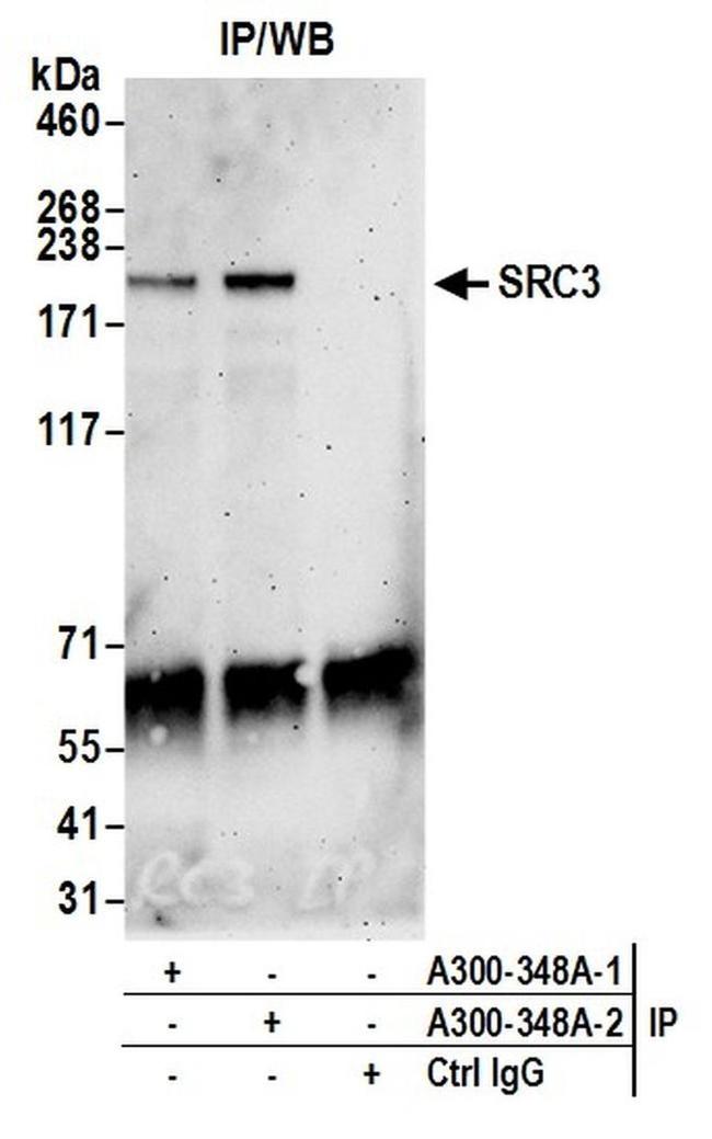 SRC3 Antibody in Western Blot (WB)