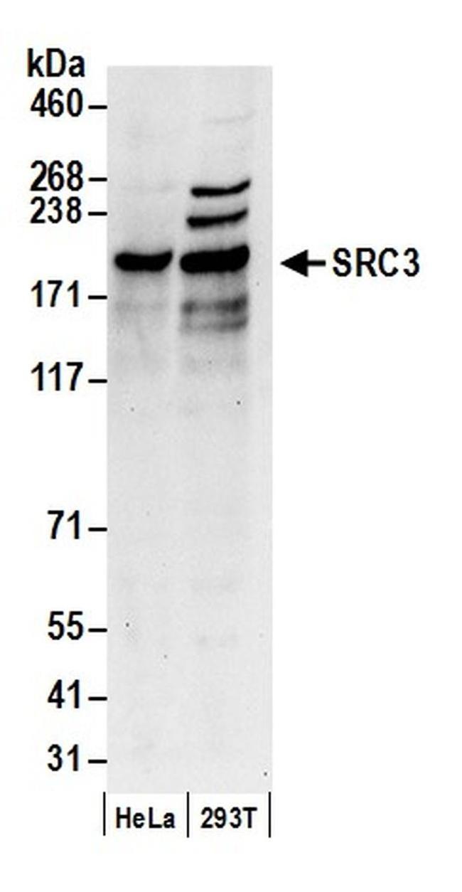 SRC3 Antibody in Western Blot (WB)