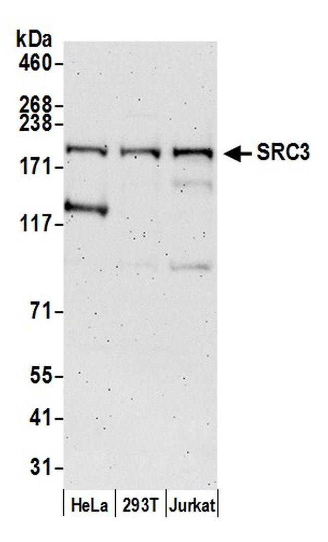 SRC3 Antibody in Western Blot (WB)