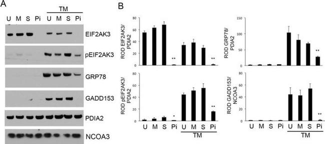 SRC3 Antibody in Western Blot (WB)