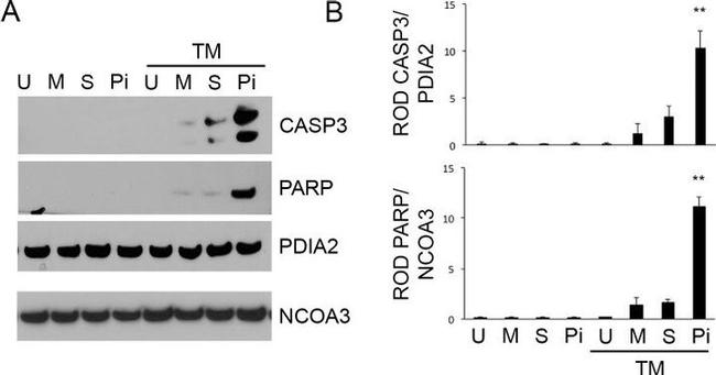 SRC3 Antibody in Western Blot (WB)