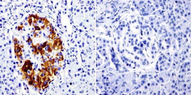 SRC3 Antibody in Immunohistochemistry (Paraffin) (IHC (P))