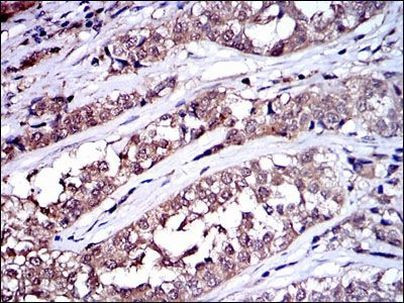 SRC Antibody in Immunohistochemistry (Paraffin) (IHC (P))