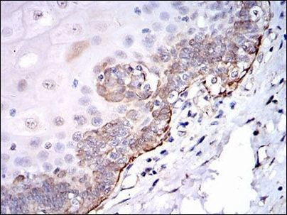 SRC Antibody in Immunohistochemistry (Paraffin) (IHC (P))