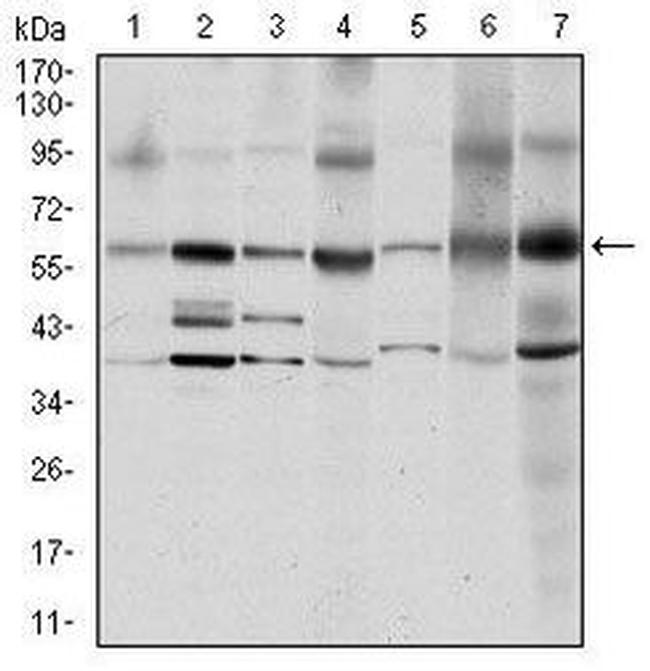 SRC Antibody in Western Blot (WB)