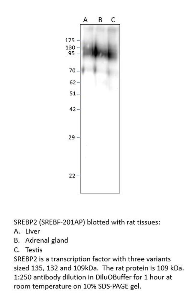 SREBP2 Antibody in Western Blot (WB)