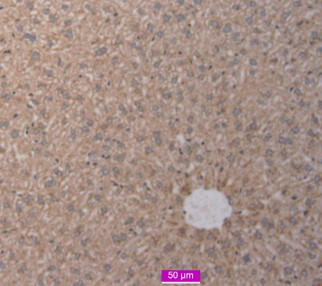 SCAP Antibody in Immunohistochemistry (Paraffin) (IHC (P))