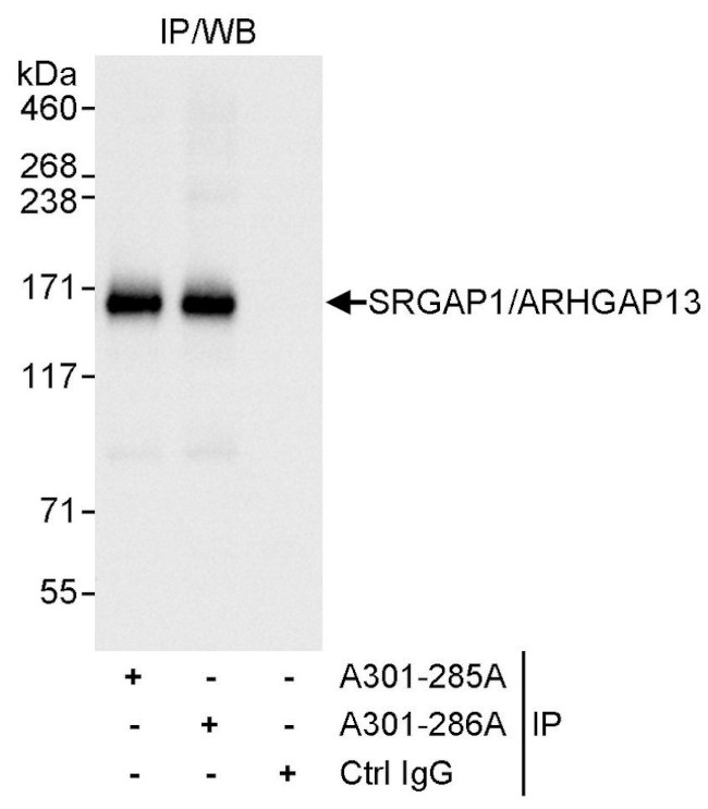 SRGAP1/ARHGAP13 Antibody in Immunoprecipitation (IP)