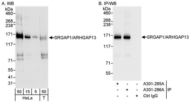 SRGAP1/ARHGAP13 Antibody in Western Blot (WB)