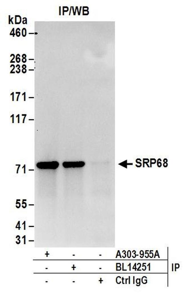 SRP68 Antibody in Western Blot (WB)