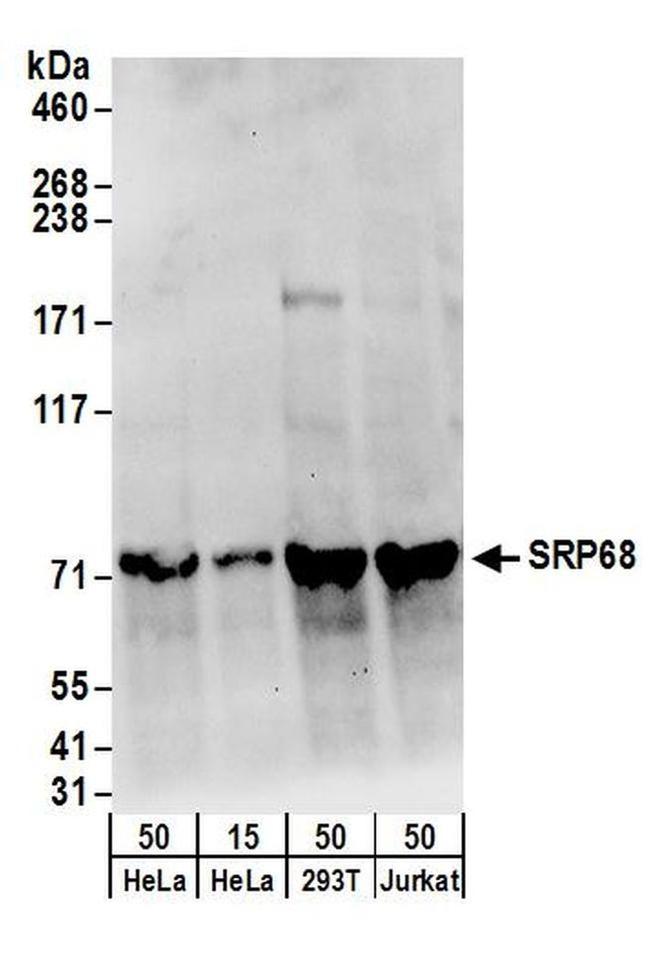 SRP68 Antibody in Western Blot (WB)