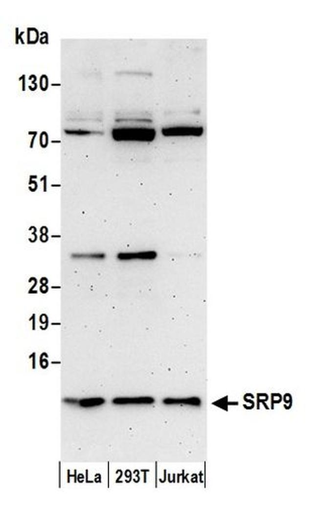 SRP9 Antibody in Western Blot (WB)