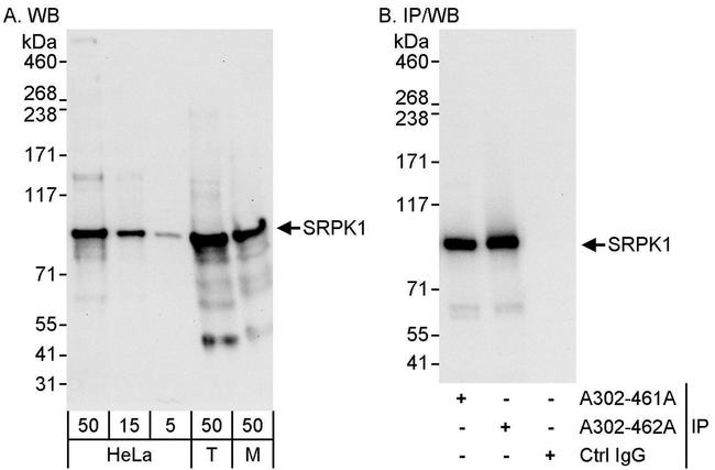 SRPK1 Antibody in Western Blot (WB)