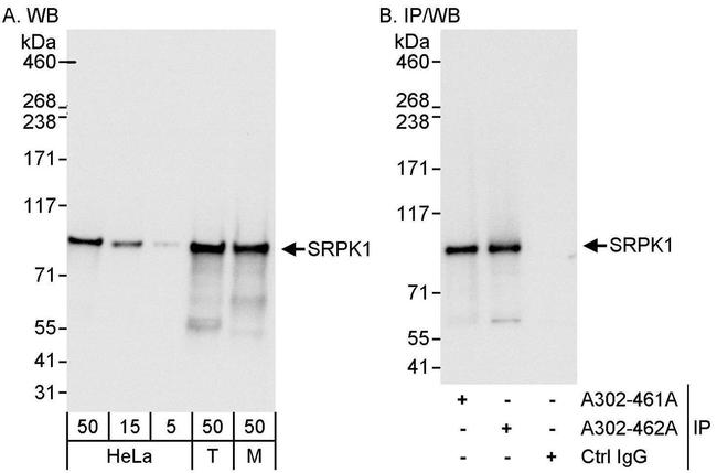 SRPK1 Antibody in Western Blot (WB)