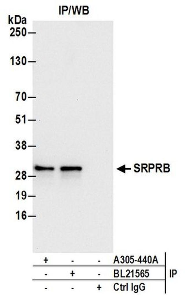 SRPRB Antibody in Western Blot (WB)