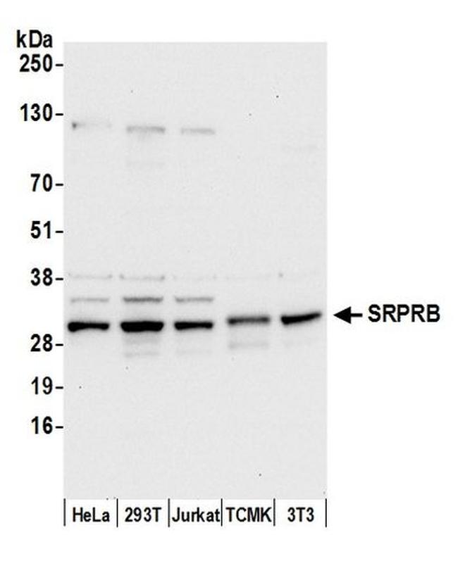 SRPRB Antibody in Western Blot (WB)