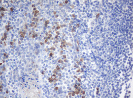 SRPRB Antibody in Immunohistochemistry (Paraffin) (IHC (P))