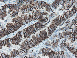 SRPRB Antibody in Immunohistochemistry (Paraffin) (IHC (P))