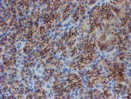 SRPRB Antibody in Immunohistochemistry (Paraffin) (IHC (P))