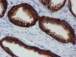 SRPRB Antibody in Immunohistochemistry (Paraffin) (IHC (P))