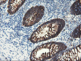 SRPRB Antibody in Immunohistochemistry (Paraffin) (IHC (P))