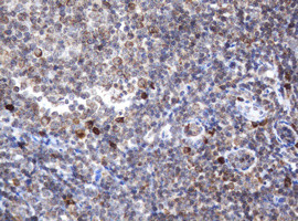 SRPRB Antibody in Immunohistochemistry (Paraffin) (IHC (P))