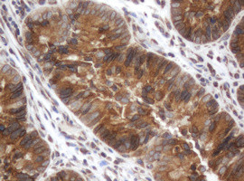 SRPRB Antibody in Immunohistochemistry (Paraffin) (IHC (P))