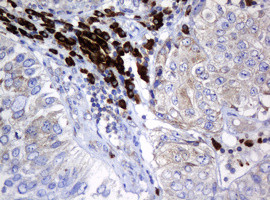 SRPRB Antibody in Immunohistochemistry (Paraffin) (IHC (P))