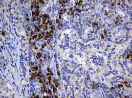 SRPRB Antibody in Immunohistochemistry (Paraffin) (IHC (P))