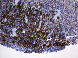 SRPRB Antibody in Immunohistochemistry (Paraffin) (IHC (P))