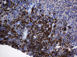 SRPRB Antibody in Immunohistochemistry (Paraffin) (IHC (P))