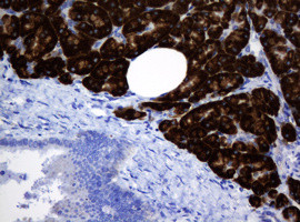 SRPRB Antibody in Immunohistochemistry (Paraffin) (IHC (P))