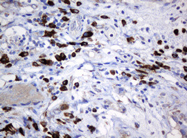 SRPRB Antibody in Immunohistochemistry (Paraffin) (IHC (P))