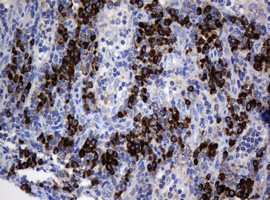 SRPRB Antibody in Immunohistochemistry (Paraffin) (IHC (P))