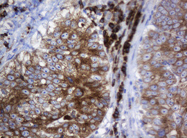 SRPRB Antibody in Immunohistochemistry (Paraffin) (IHC (P))